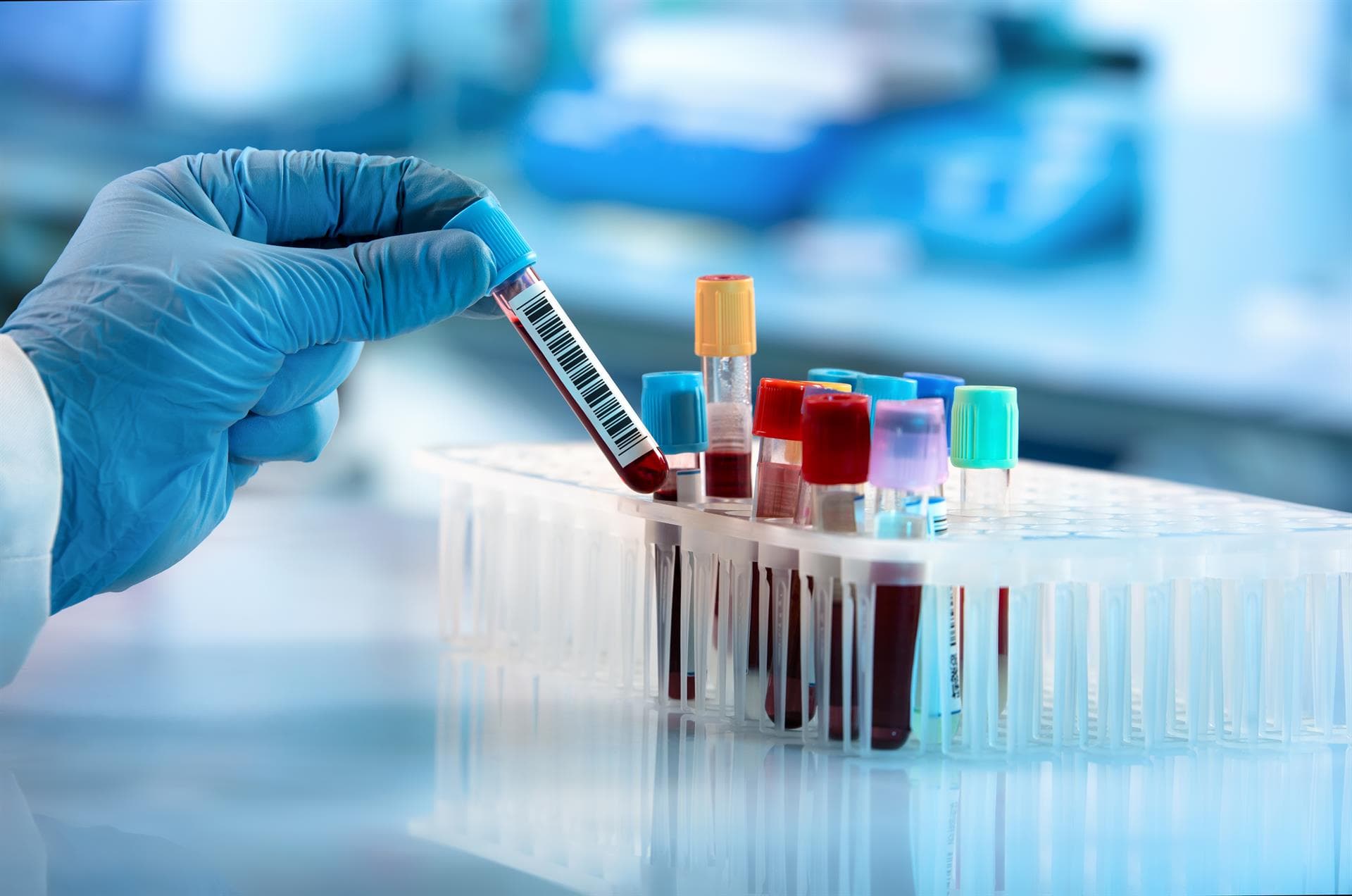 Detección de trisomías en sangre materna para detectar alteraciones cromosómicas